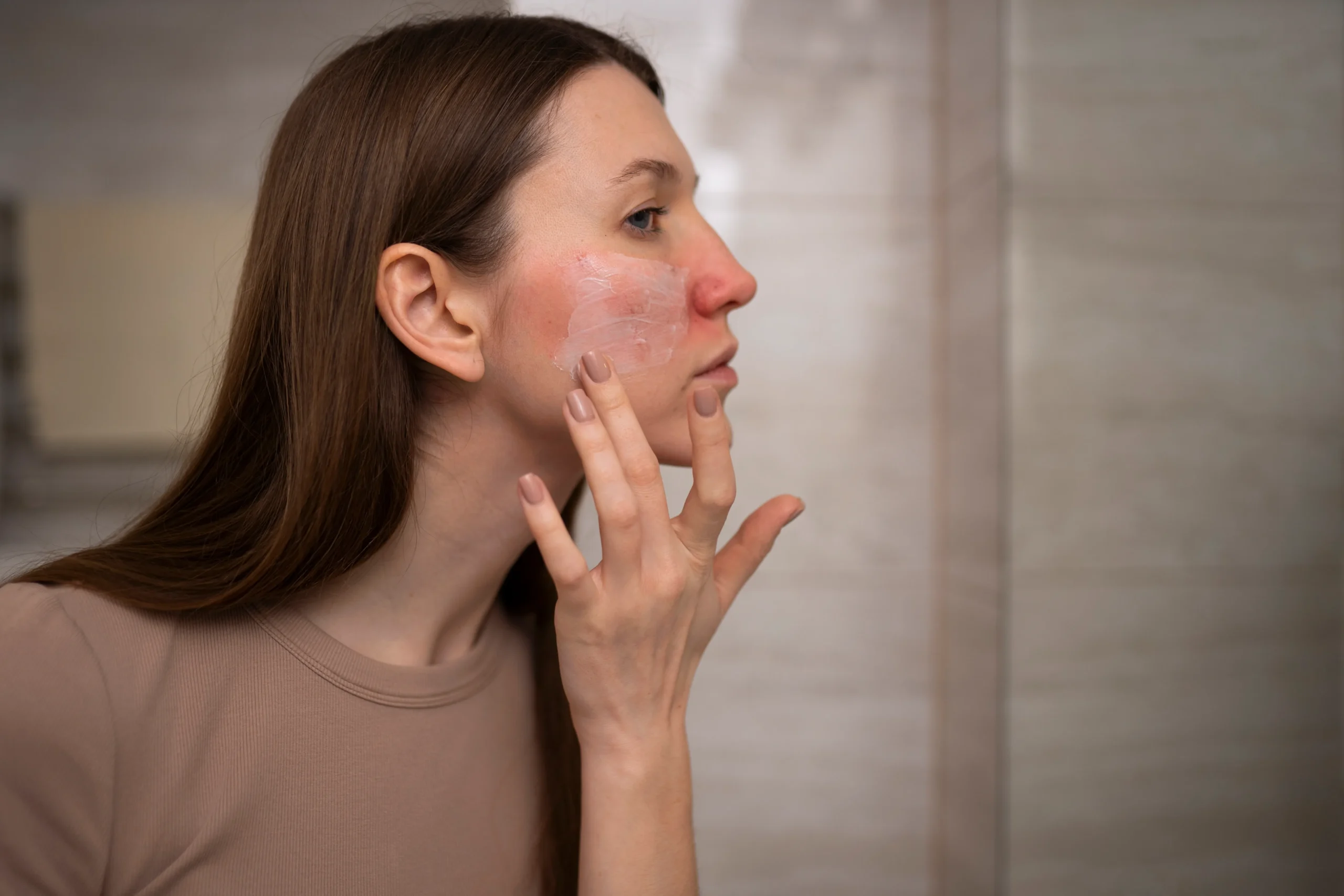 Skin Barrier
